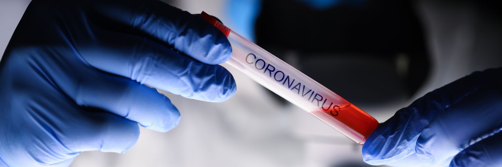 Coronavirus: comment les services de l'éducation et de la petite enfance peuvent faire face à ce black-out ? Session 2